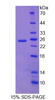 Recombinant Dystrobrevin Binding Protein 1 (DTNBP1)