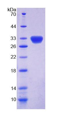 Recombinant Dyskerin (DKC)