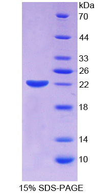 Recombinant Epithelial Cell Transforming Sequence 2 (ECT2)