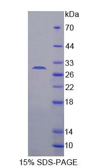 Recombinant CCAAT/Enhancer Binding Protein Delta (CEBPd)