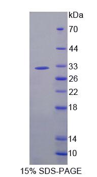 Recombinant Exonuclease 1 (EXO1)