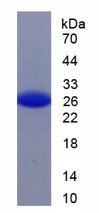 Recombinant Fibroblast Activation Protein Alpha (FAPa)