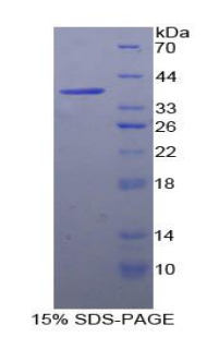 Recombinant Fatty Acid Synthase (FASN)