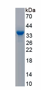 Recombinant Fatty Acid Synthase (FASN)