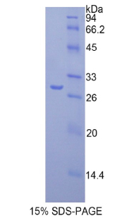 Recombinant Fatty Acid Synthase (FASN)