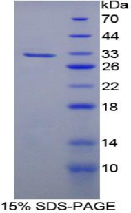 Recombinant Fatty Acid Synthase (FASN)