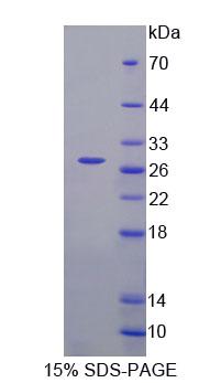 Recombinant Fas Activated Serine/Threonine Kinase (FASTK)