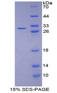 Recombinant Fibulin 1 (FBLN1)