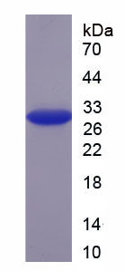 Recombinant Fibrinogen Gamma (FGg)