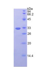 Recombinant Fibrinogen Gamma (FGg)