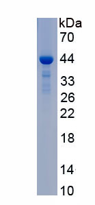 Recombinant Ferrochelatase (FECH)