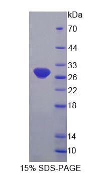 Recombinant Fibrillarin (FBL)