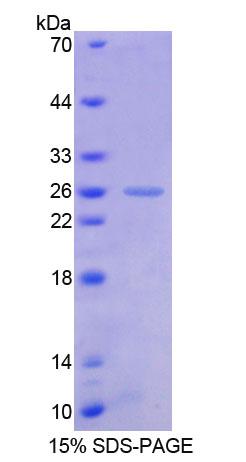 Recombinant Friend Leukemia Virus Integration 1 (FLI1)