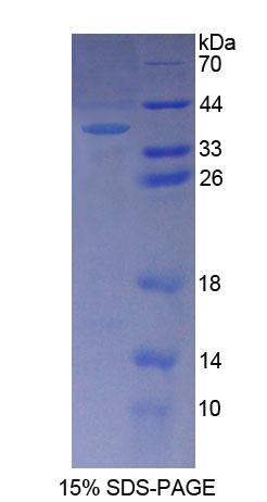 RPC498Hu01.jpg