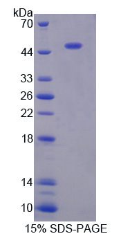 Recombinant Gastrokine 1 (GKN1)