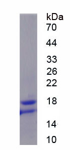 Recombinant Gastrokine 1 (GKN1)