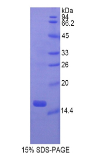 Recombinant Gastrokine 1 (GKN1)