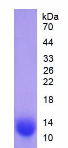 Recombinant Glucocerebrosidase (GBA)