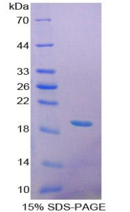 Recombinant Glucocerebrosidase (GBA)