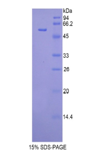 Recombinant Glucocerebrosidase (GBA)