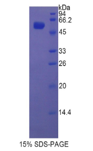 Recombinant Glucocerebrosidase (GBA)