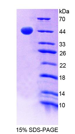 Recombinant Growth Hormone Releasing Hormone Receptor (GHRHR)