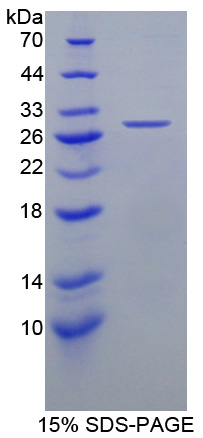 Recombinant High Density Lipoprotein Binding Protein (HDLBP)