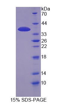 RPC542Hu01.jpg