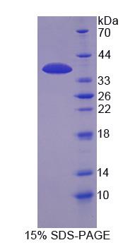 Recombinant Inositol Hexaphosphate Kinase 1 (IHPK1)