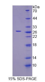 Recombinant Inosine Triphosphatase Pyrophosphatase (ITPA)