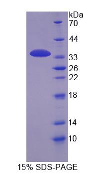 Recombinant Keratocan (KERA)