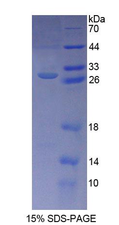 Recombinant Karyopherin Alpha 3 (KPNa3)