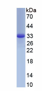 Recombinant Kinectin 1 (KTN1)