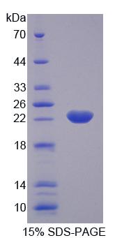 Recombinant Kinectin 1 (KTN1)