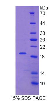 Recombinant Kisspeptin 1 (KISS1)