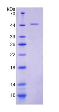 Recombinant Kisspeptin 1 (KISS1)