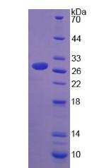 Recombinant L-Plastin (LCP1)