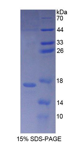 Recombinant Eukaryotic translation initiation factor 2D (EIF2D)