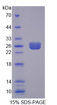 Recombinant Eukaryotic translation initiation factor 2D (EIF2D)