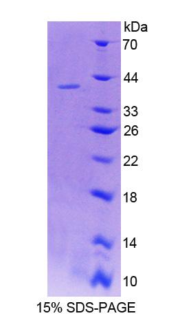 Recombinant Lens Intrinsic Membrane Protein 2 (LIM2)