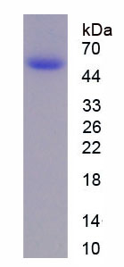 Recombinant Lacritin (LACRT)