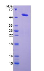 Recombinant Lysyl Oxidase (LOX)