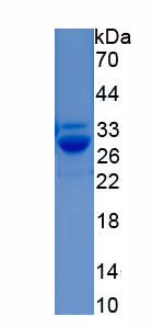 RPC584Hu01.jpg