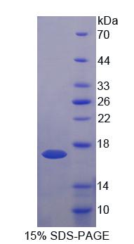 Recombinant Ubiquinol Cytochrome C Reductase Binding Protein (UQCRB)