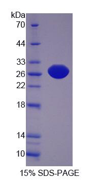 Recombinant Xanthine Dehydrogenase (XDH)