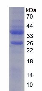 Recombinant Y-Box Binding Protein 1 (YBX1)