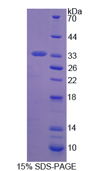 Recombinant Zona Pellucida Glycoprotein 2, Sperm Receptor (ZP2)