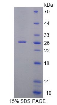 Recombinant Zuotin Related Factor 1 (ZRF1)