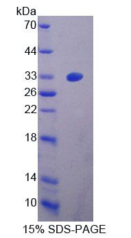 Recombinant Zuotin Related Factor 1 (ZRF1)