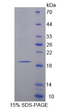 Recombinant Macrophage Receptor With Collagenous Structure (MARCO)